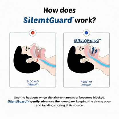 SilentGuard™ Anti-Snoring Mouthpiece